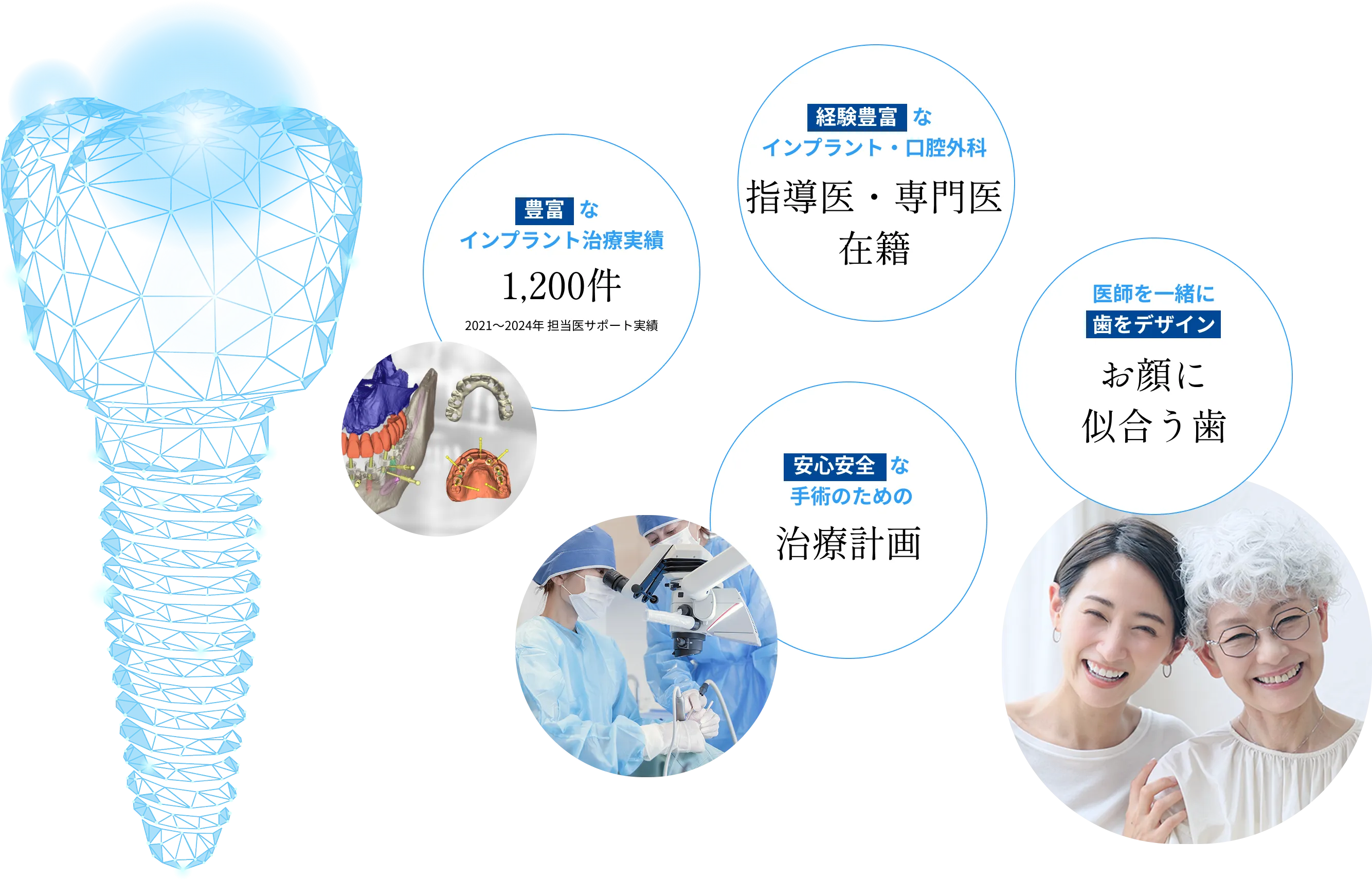 豊富なインプラント治療実績 経験豊富なインプラント・口腔外科指導医・専門医在籍 安心安全な手術のための治療計画 医師を一緒に歯をデザインお顔に似合う歯