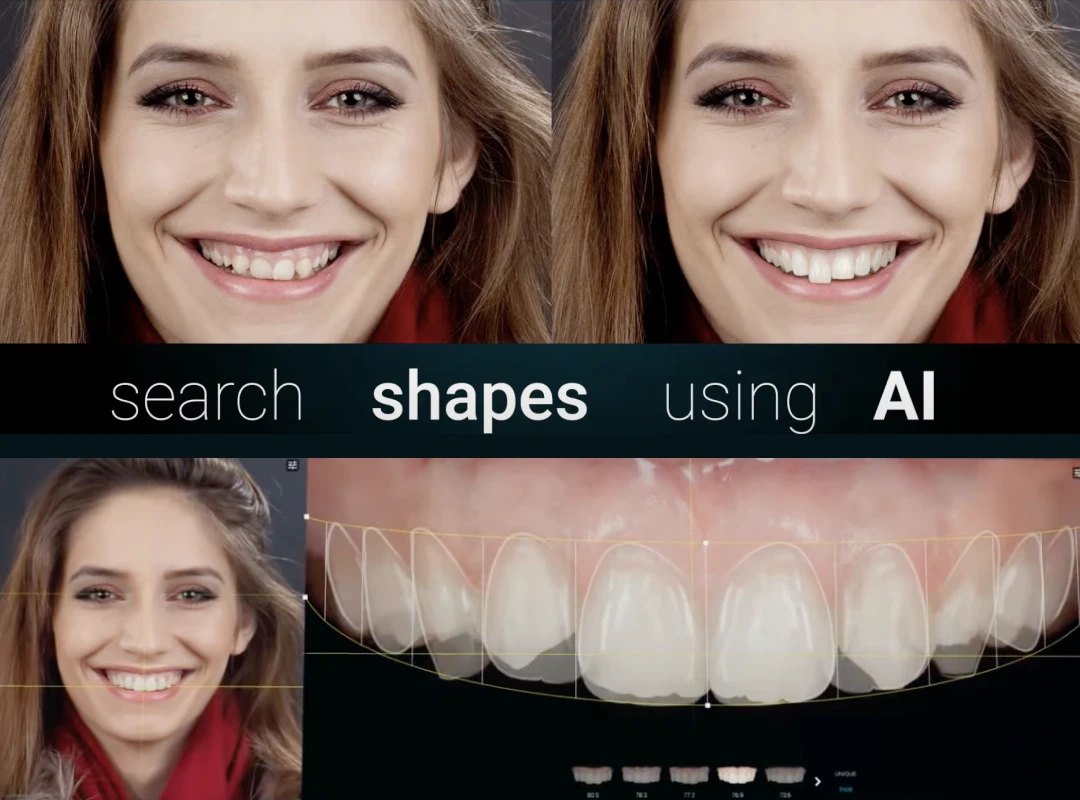 イメージ:審美治療